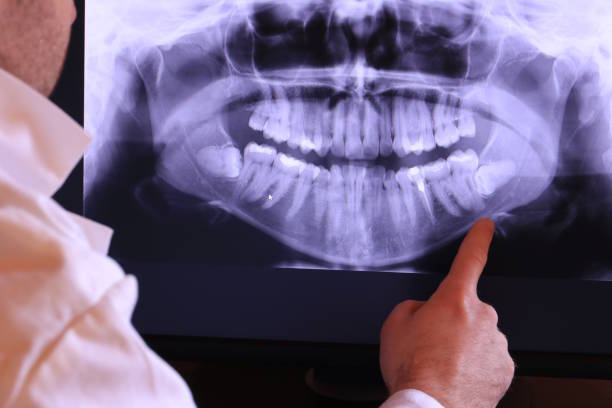 Best Emergency Dental Care for Broken or Chipped Teeth in Cinco Ranch, TX