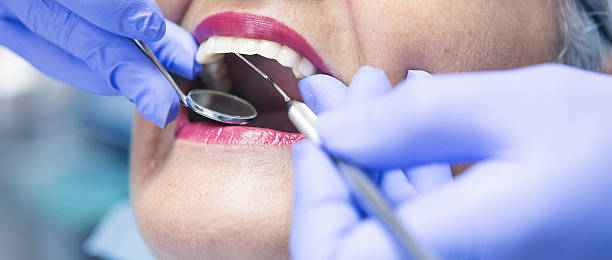 Best Emergency Gum Treatment in Cinco Ranch, TX